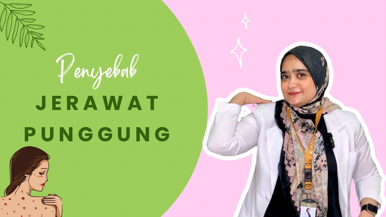 Rahasia Mengatasi Jerawat Punggung untuk Penampilan Percaya Diri dan Bebas Gangguan!