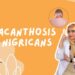 ilustrasi acanthosis nigricans pada kulit dengan area gelap di lipatan tubuh sebagai tanda masalah kesehatan kulit