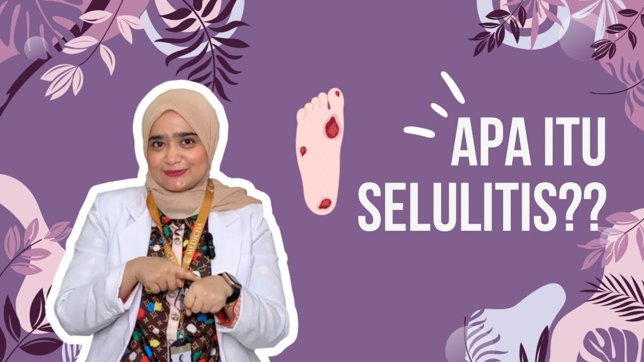 Rahasia Mengatasi Selulitis: Cara Efektif Menjaga Kesehatan Kulit Anda!