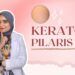 Keratosis Pilaris: Penyebab, Ciri, dan Pengobatan