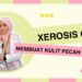 Xerosis Kutis: Kulit Kering, Penyebab, Gejala, dan Perawatan