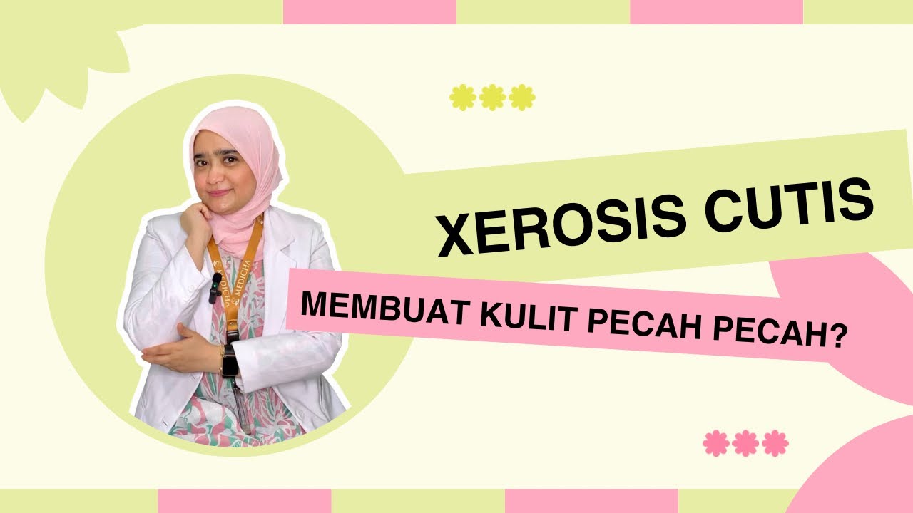 Rahasia di Balik Kulit Pecah-Pecah: Apakah Xerosis Penyebabnya?