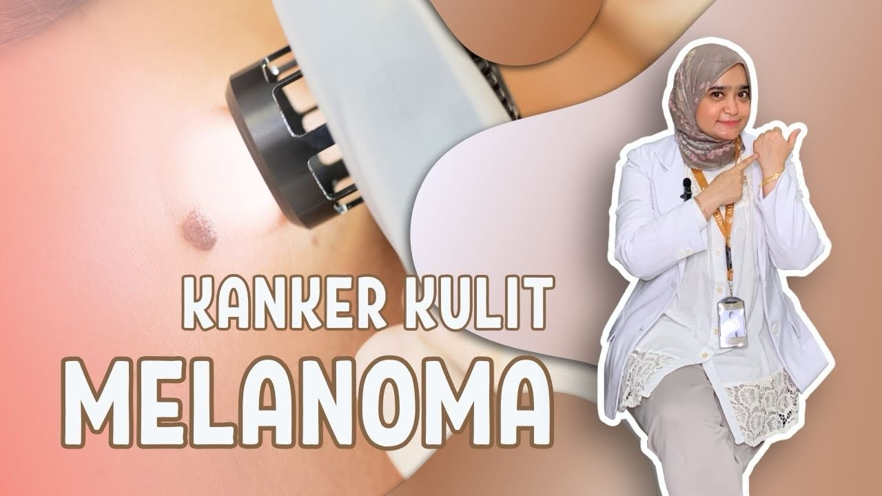 Mengungkap Rahasia Melanoma: Apa yang Perlu Anda Ketahui untuk Melindungi Diri Anda?