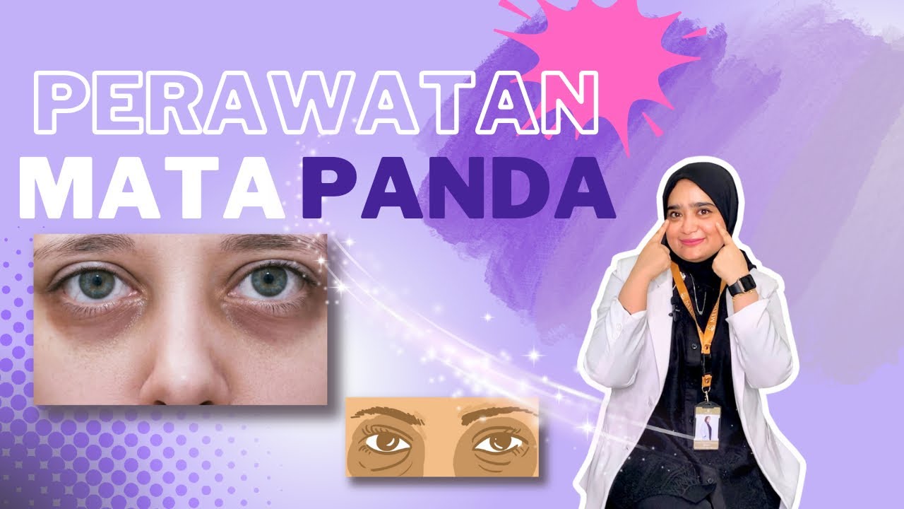 Rahasia Ampuh Mengatasi Mata Panda yang Harus Anda Ketahui!
