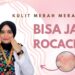 Mengenal Tanda dan Penyebab Rosacea Magang Dr. Icha Aisyah Medicha Health Skin Clinic Center