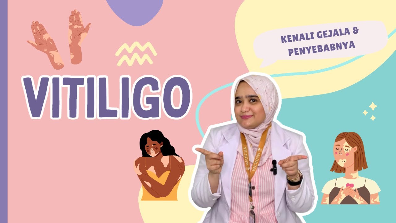 Mengungkap Rahasia di Balik Vitiligo: Apa yang Sebenarnya Menjadi Penyebabnya?