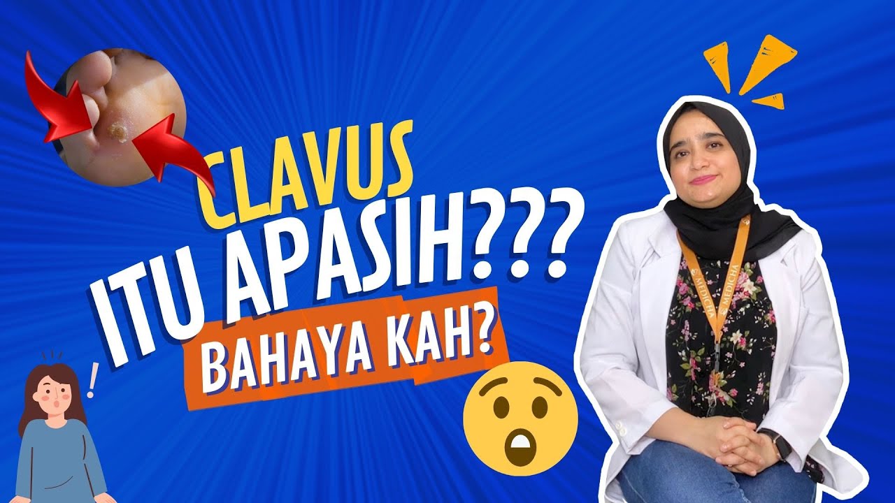 Temukan Penyebab Utama Clavus dan Cara Ampuh Mengatasinya!