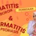 Perbedaan dermatitis seboroik dan psoriasis: sisik tipis kuning vs sisik tebal perak.