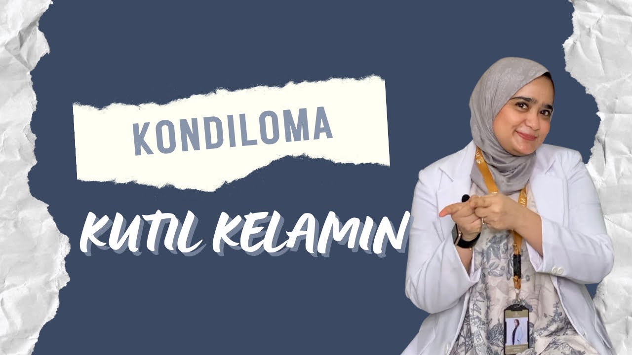 Mengungkap Bahaya Kondiloma: Apa yang Harus Anda Ketahui untuk Kesehatan Anda?