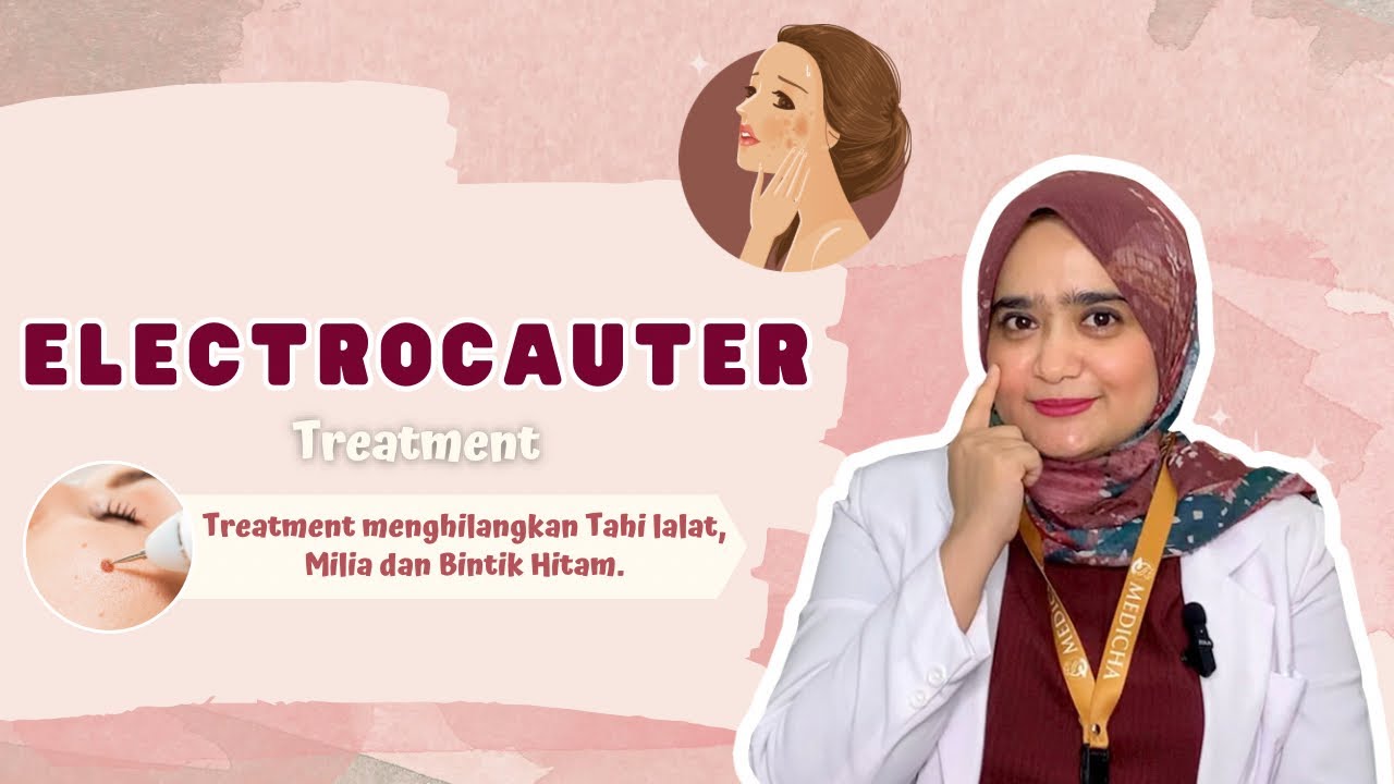 Mengenal Electrocauter: Solusi Revolusioner dalam Penanganan Jaringan yang Efektif dan Aman