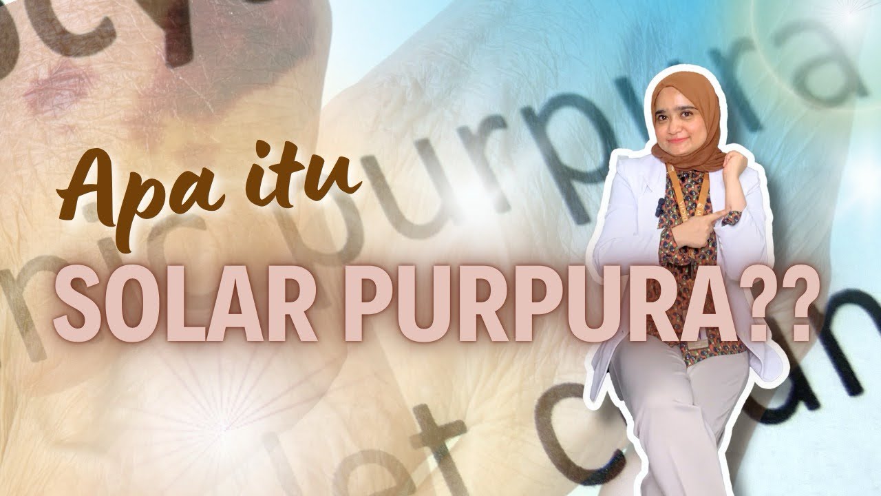 Strategi Efektif untuk Mencegah Solar Purpura: Lindungi Kulit Anda dari Risiko yang Tersembunyi