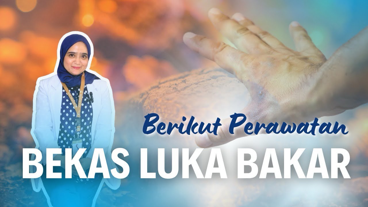 Rahasia Efektif Mengatasi Bekas Luka Bakar: Temukan Solusi yang Mengubah Penampilan Anda!