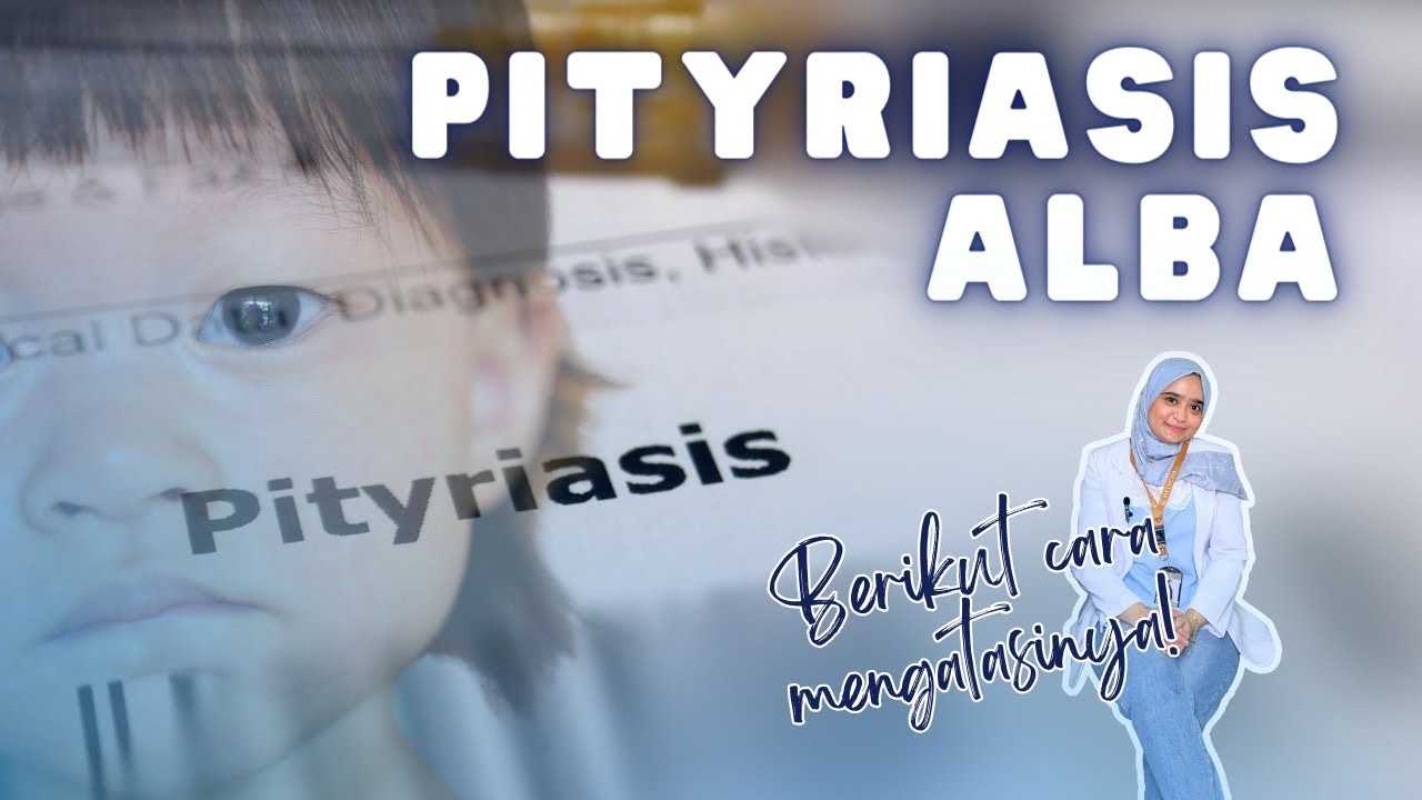 Mengungkap Rahasia Pityriasis Alba: Solusi Ampuh untuk Kulit Cerah dan Sehat!