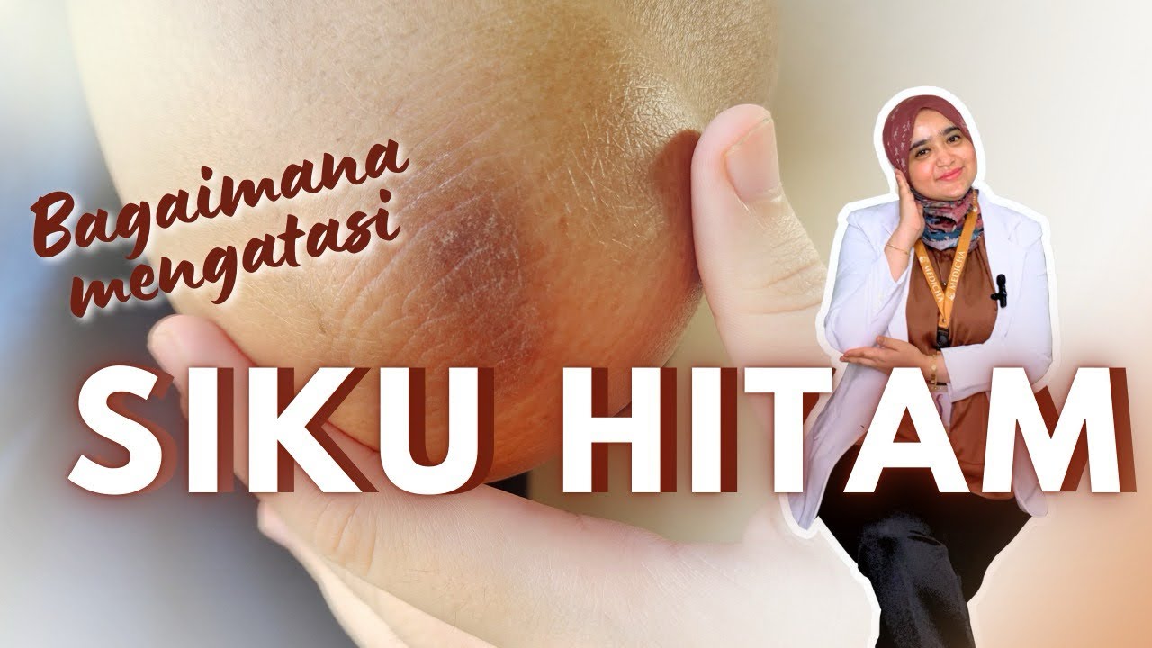 Rahasia Ampuh Mengatasi Siku Hitam dan Mendapatkan Kulit Cerah yang Sempurna